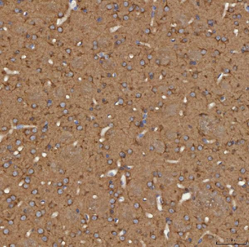 Anti-SEC31A Antibody