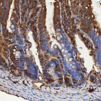 Anti-SEC31A Antibody
