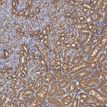 Anti-SEC31A Antibody