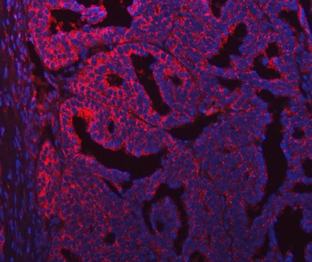 Anti-SEC31A Antibody