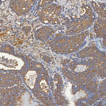 Anti-SEC31A Antibody