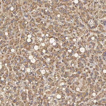 Anti-SEC31A Antibody