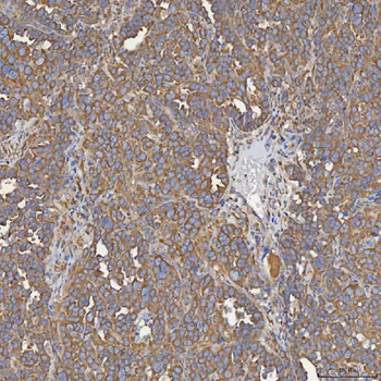 Anti-SEC31A Antibody
