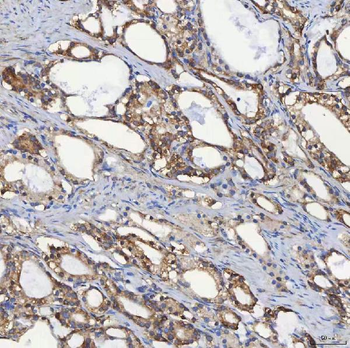 Anti-SEC31A Antibody