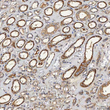 Anti-SEC31A Antibody