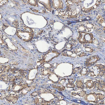 Anti-SEC23IP Antibody