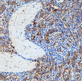 Anti-SEC23IP Antibody