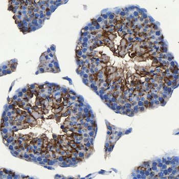 Anti-SEC23IP Antibody