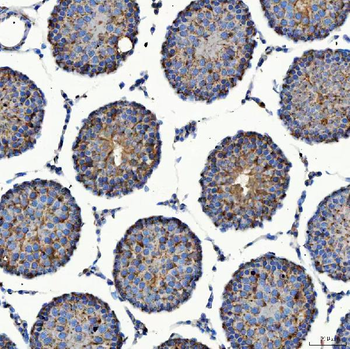 Anti-SEC23IP Antibody