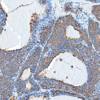 Anti-SEC23IP Antibody
