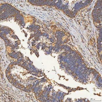 Anti-SEC23IP Antibody