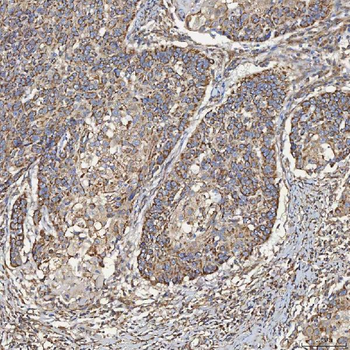 Anti-SEC23IP Antibody
