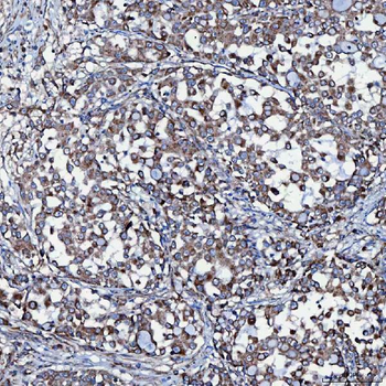 Anti-SEC23IP Antibody