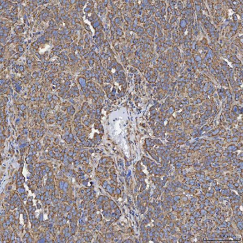 Anti-SEC23IP Antibody