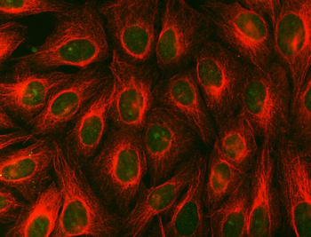 Anti-Syntenin 2/SDCBP2 Antibody
