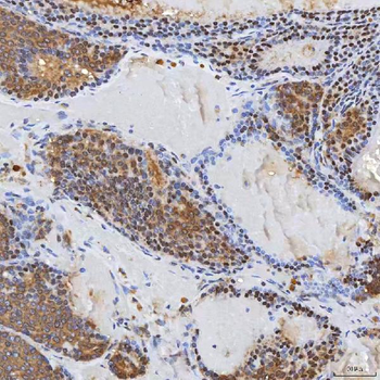 Anti-Syntenin 2/SDCBP2 Antibody