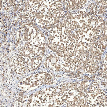 Anti-Syntenin 2/SDCBP2 Antibody