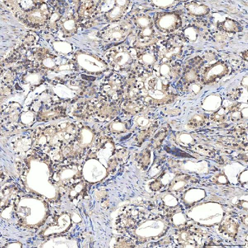 Anti-Syntenin 2/SDCBP2 Antibody