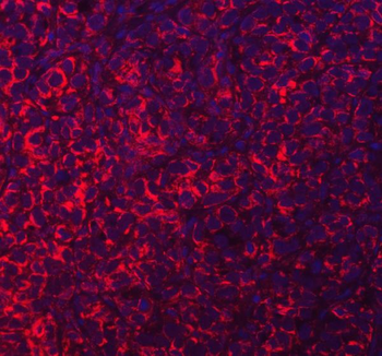 Anti-ACAD9 Antibody