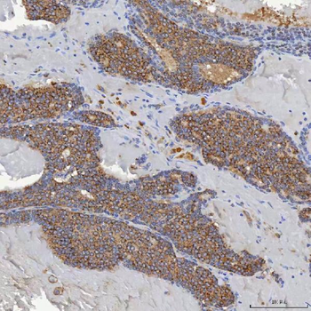 Anti-ACAD9 Antibody