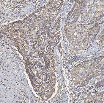 Anti-ACAD9 Antibody