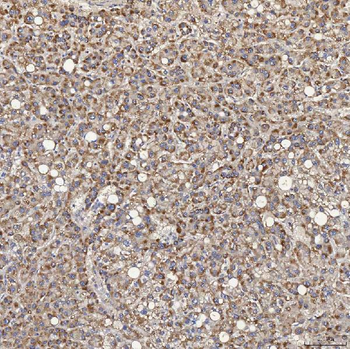 Anti-ACAD9 Antibody