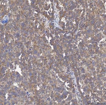 Anti-ACAD9 Antibody