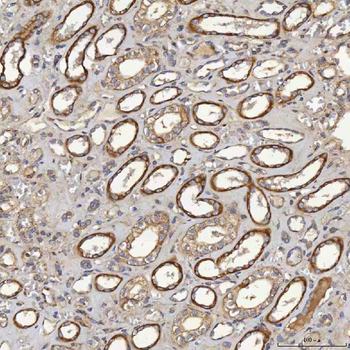 Anti-ACAD9 Antibody