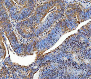 Anti-TTLL12 Antibody