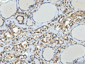Anti-TTLL12 Antibody