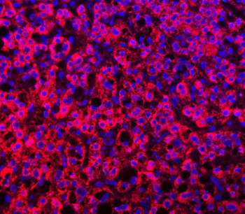 TTLL2 Antibody