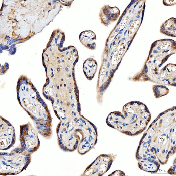 Anti-TTLL2 Antibody