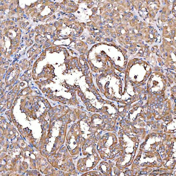 Anti-TTLL2 Antibody