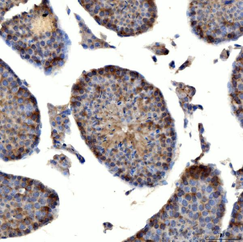 Anti-TTLL2 Antibody