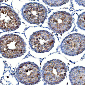 Anti-TTLL2 Antibody