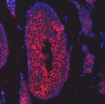 Anti-TTLL2 Antibody