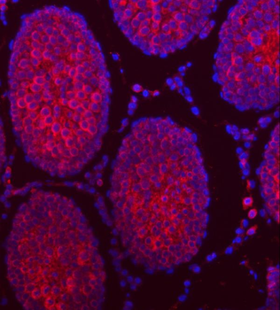 Anti-TTLL2 Antibody