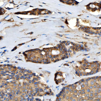 Anti-TTLL2 Antibody