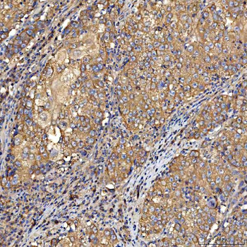 Anti-TTLL2 Antibody
