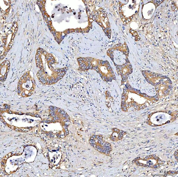 Anti-TTLL2 Antibody