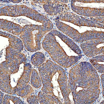 Anti-TTLL2 Antibody