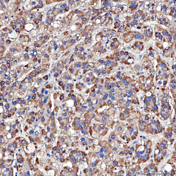 Anti-TTLL2 Antibody