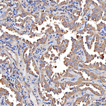 Anti-TTLL2 Antibody