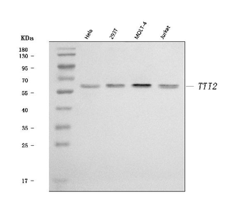 Anti-TTI2 Antibody