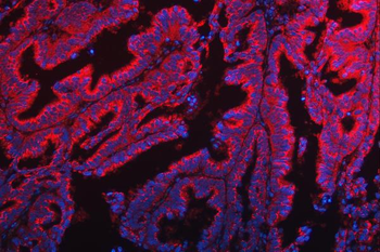 Anti-TTC7B Antibody