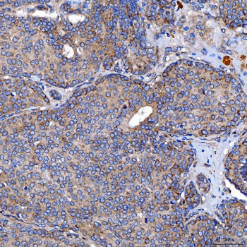 Anti-TTC7B Antibody
