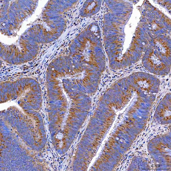 Anti-TTC7B Antibody