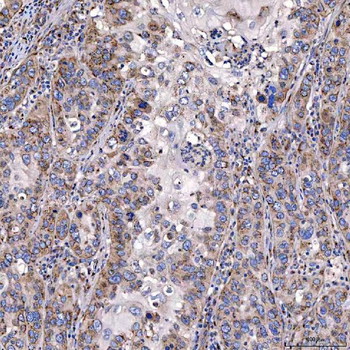 Anti-TTC7B Antibody