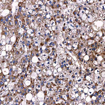 Anti-TTC7B Antibody