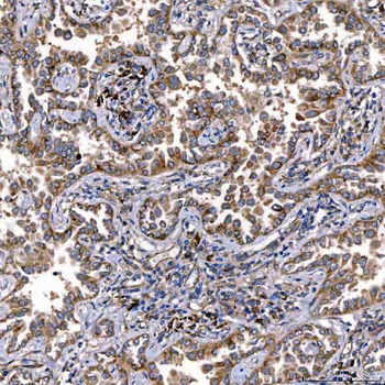 Anti-TTC7B Antibody